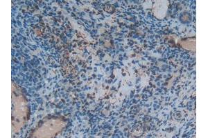 Used in DAB staining on fromalin fixed paraffin-embedded lung tissue (S100A6 anticorps  (AA 1-89))