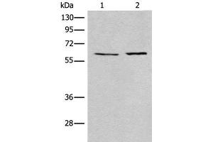 Western blot analysis of A172 and Jurkat cell lysates using USP14 Polyclonal Antibody at dilution of 1:400