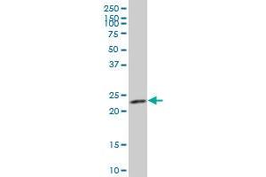 anti-ADP-Ribosylation Factor Related Protein 1 (ARFRP1) (AA 133-201) antibody