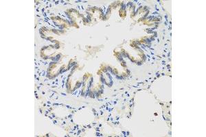 Immunohistochemistry of paraffin-embedded rat lung using TICAM1 antibody (ABIN6292306) at dilution of 1:100 (40x lens). (TICAM1 anticorps)