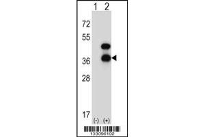 Western blot analysis of CD72 using rabbit polyclonal CD72 Antibody using 293 cell lysates (2 ug/lane) either nontransfected (Lane 1) or transiently transfected (Lane 2) with the CD72 gene. (CD72 anticorps  (AA 176-203))
