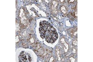 Immunohistochemical staining (Formalin-fixed paraffin-embedded sections) of human kidney with DYSF polyclonal antibody  shows strong positivity in the glomeruli and moderate membranous staining in tubular cells. (Dysferlin anticorps)