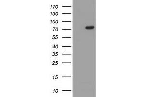 HEK293T cells were transfected with the pCMV6-ENTRY control (Left lane) or pCMV6-ENTRY C17orf28 (Right lane) cDNA for 48 hrs and lysed. (HID1/DMC1 anticorps)