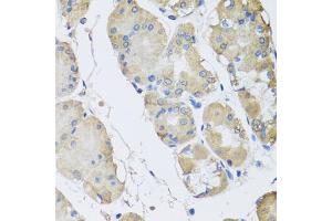 Immunohistochemistry of paraffin-embedded human stomach using RPLP1 antibody (ABIN5974064) at dilution of 1/100 (40x lens). (RPLP1 anticorps)