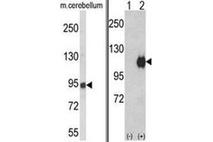 (LEFT) Western blot analysis of ENPP2 Antibody (Center) in mouse cerebellum tissue lysates (35ug/lane). (ENPP2 anticorps  (Middle Region))