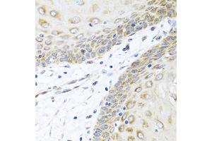 Immunohistochemistry of paraffin-embedded human esophagus using INHBC antibody (ABIN5975306) at dilution of 1/100 (40x lens). (INHBC anticorps)