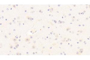 Detection of PDGF BB in Mouse Cerebrum Tissue using Polyclonal Antibody to Platelet Derived Growth Factor BB (PDGF BB) (PDGF-BB Homodimer (AA 21-241) anticorps)