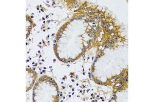 Immunohistochemistry of paraffin-embedded human stomach using CAMLG antibody (ABIN6129359, ABIN6137896, ABIN6137897 and ABIN6217819) at dilution of 1:100 (40x lens).