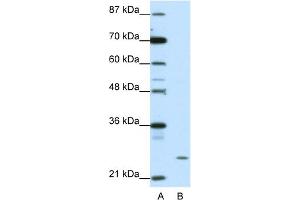 WB Suggested Anti-ZNF253 Antibody Titration:  1. (ZNF253 anticorps  (C-Term))