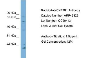 WB Suggested Anti-CYP2R1  Antibody Titration: 0.