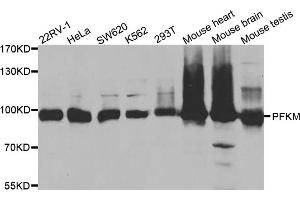 Western blot analysis of extracts of various cell lines, using PFKM antibody (ABIN5973190) at 1/1000 dilution. (PFKM anticorps)