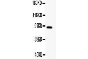 Anti- DISC1 antibody, Western blottingAll lanes: Anti DISC1  at 0. (DISC1 anticorps  (Middle Region))
