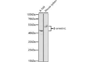 Western blot analysis of extracts of various cell lines, using β-arrestin1 antibody (ABIN6127452, ABIN6137135, ABIN6137136 and ABIN6213655) at 1:1000 dilution. (beta Arrestin 1 anticorps  (AA 169-418))