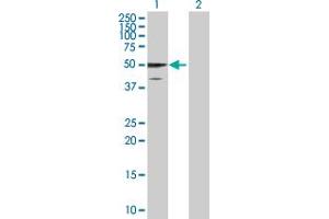 Western Blot analysis of GFAP expression in transfected 293T cell line by GFAP MaxPab polyclonal antibody. (GFAP anticorps  (AA 1-432))