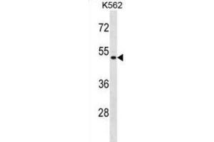 Western Blotting (WB) image for anti-Enolase Superfamily Member 1 (ENOSF1) antibody (ABIN2998739) (ENOSF1 anticorps)