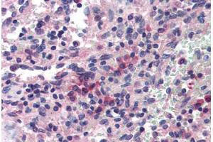 Human Spleen (formalin-fixed, paraffin-embedded) stained with SAE1 antibody ABIN214379 at 5 ug/ml followed by biotinylated goat anti-rabbit IgG secondary antibody ABIN481713, alkaline phosphatase-streptavidin and chromogen. (SAE1 anticorps)