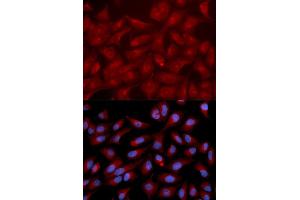 Immunofluorescence analysis of U2OS cell using RAPGEF3 antibody. (RAPGEF3 anticorps)