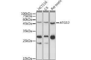 Western blot analysis of extracts of various cell lines, using  antibody (ABIN7265789) at 1:1000 dilution. (ATG12 anticorps  (AA 1-74))