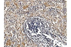 IHC analysis of GFPT1 using anti-GFPT1 antibody (ABIN7602887). (GFPT1 anticorps  (C-Term))