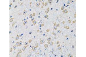 Immunohistochemistry of paraffin-embedded Mouse brain using MSRA Polyclonal Antibody at dilution of 1:100 (40x lens). (MSRA anticorps)