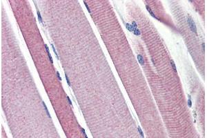 Human Skeletal Muscle (formalin-fixed, paraffin-embedded) stained with HK2 antibody ABIN462257 followed by biotinylated goat anti-rabbit IgG secondary antibody ABIN481713, alkaline phosphatase-streptavidin and chromogen.