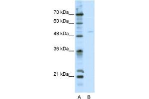 WB Suggested Anti-TFEB Antibody Titration:  2. (TFEB anticorps  (C-Term))