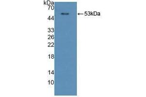 Western blot analysis of recombinant Human CPR. (POR anticorps  (AA 77-518))