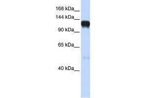 WB Suggested Anti-EPHA5 Antibody Titration: 0. (EPH Receptor A5 anticorps  (Middle Region))