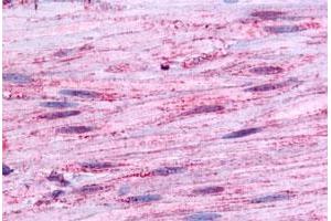 Immunohistochemical staining of human smooth muscle with BDKRB1 polyclonal antibody . (BDKRB1 anticorps  (Extracellular Domain))