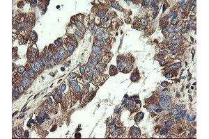 Image no. 4 for anti-Ubiquitin-Conjugating Enzyme E2, J1, U (UBE2J1) antibody (ABIN1501638)