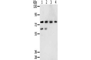 Gel: 6 % SDS-PAGE, Lysate: 40 μg, Lane 1-4: A549 cells, hepg2 cells, lovo cells, A431 cells, Primary antibody: ABIN7131407(TMPRSS7 Antibody) at dilution 1/250, Secondary antibody: Goat anti rabbit IgG at 1/8000 dilution, Exposure time: 5 minutes (TMPRSS7 anticorps)