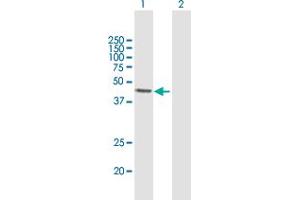 Western Blot analysis of ALKBH1 expression in transfected 293T cell line by ALKBH1 MaxPab polyclonal antibody. (ALKBH1 anticorps  (AA 1-389))