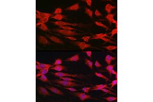 Immunofluorescence analysis of C6 cells using p70 S6 Kinase 1 1 Rabbit pAb (ABIN3023168, ABIN3023169, ABIN3023170, ABIN1513490 and ABIN6219422) at dilution of 1:100 (40x lens).