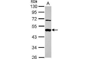 WB Image Sample (30 ug of whole cell lysate) A: A431 , 10% SDS PAGE antibody diluted at 1:1000 (MEK2 anticorps)