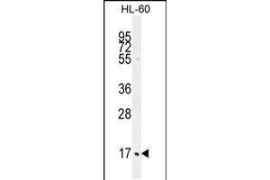 Western blot analysis in HL-60 cell line lysates (35ug/lane). (C1QC anticorps  (AA 93-120))