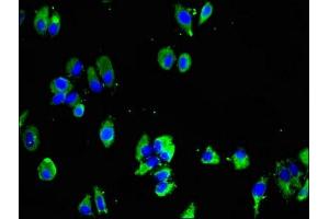 Immunofluorescent analysis of HepG2 cells using ABIN7159316 at dilution of 1:100 and Alexa Fluor 488-congugated AffiniPure Goat Anti-Rabbit IgG(H+L) (Melatonin Receptor 1B anticorps  (AA 1-42))