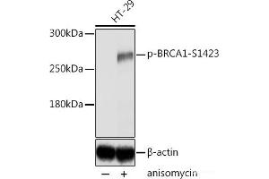 Western blot analysis of extracts of HT-29 cells using Phospho-BRCA1(S1423) Polyclonal Antibody at dilution of 1:2000. (BRCA1 anticorps  (pSer1423))