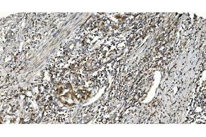 IHC analysis of NOX2/gp91phox/CYBB using anti-NOX2/gp91phox/CYBB antibody (ABIN7599875). (CYBB anticorps  (AA 124-559))