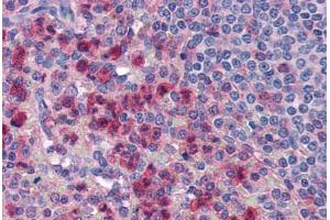 Human Spleen, Neutrophils (formalin-fixed, paraffin-embedded) stained with IL27 antibody ABIN351442 at 5 ug/ml followed by biotinylated goat anti-rabbit IgG secondary antibody ABIN481713, alkaline phosphatase-streptavidin and chromogen. (IL-27 anticorps  (Internal Region))