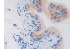 DAB staining on IHC-P; Samples: Mouse Vas Deferens Tissue