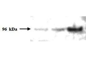 Western Blotting (WB) image for anti-PMS2 Postmeiotic Segregation Increased 2 (S. Cerevisiae) (PMS2) (AA 58-81) antibody (ABIN400795)
