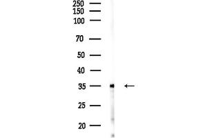Western blot analysis of lysates from COLO205 cells(UV,30 min treatment), using S Antibody at 1/1000 dilution.