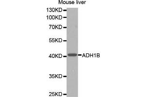 Western Blotting (WB) image for anti-Alcohol Dehydrogenase 1B (Class I), beta Polypeptide (ADH1B) (AA 206-375) antibody (ABIN1678576) (ADH1B anticorps  (AA 206-375))