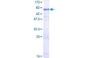 Image no. 1 for Deafness, Autosomal Dominant 5 (DFNA5) (AA 1-496) protein (GST tag) (ABIN1351484)