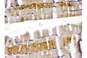 Cofilin 2 was detected in paraffin-embedded sections of rat skeletal muscle tissues using rabbit anti- Cofilin 2 Antigen Affinity purified polyclonal antibody (Catalog # ) at 1 µg/mL.