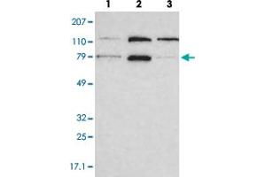 Western blot analysis of lane 1: RT-4, lane 2: EFO-21 and lane 3: A-431 cell lysates using PNN polyclonal antibody . (PNN anticorps)