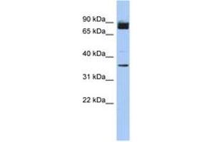 Image no. 1 for anti-Coiled-Coil Serine-Rich Protein 1 (CCSER1) (AA 71-120) antibody (ABIN6743951) (CCSER1 anticorps  (AA 71-120))