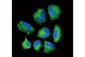 Confocal immunofluorescent analysis of CHAT antibody with NCI-H460 cells followed by Alexa Fluor 488-conjugated goat anti-rabbit lgG (green).