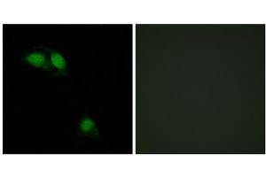 Immunofluorescence analysis of HeLa cells, using IRS-1 (Phospho-Ser312) antibody. (IRS1 anticorps  (pSer312))