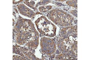 IHC analysis of GRB10 using anti-GRB10 antibody (ABIN7599160). (GRB10 anticorps  (AA 1-251))